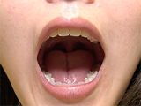 神アングルで激カワ美女のとってもレアな口内観察！